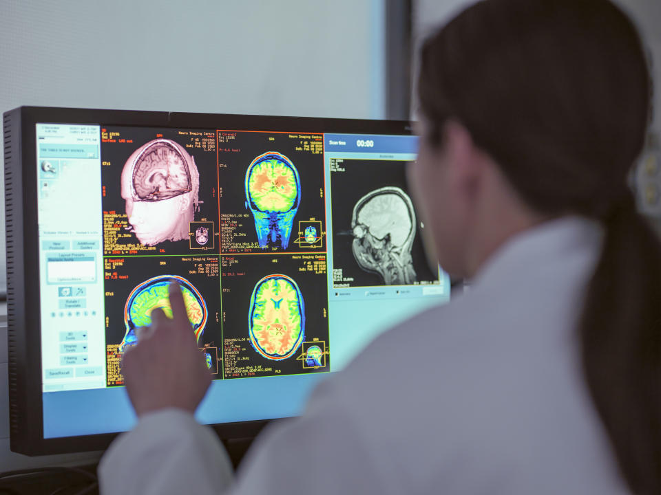 researcher looking at brain scans