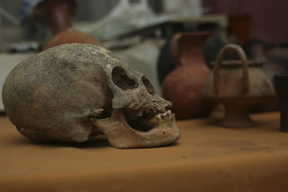 An elongated skull is shown on Thursday, Nov. 15, 2018 from one of the tombs found at a Bolivian quarry near the capital of La Paz. The tombs contained remains belonging to more than 100 individuals and were buried with more than 30 vessels used by the Incas. (AP Photo/Luis Gandarillas)
