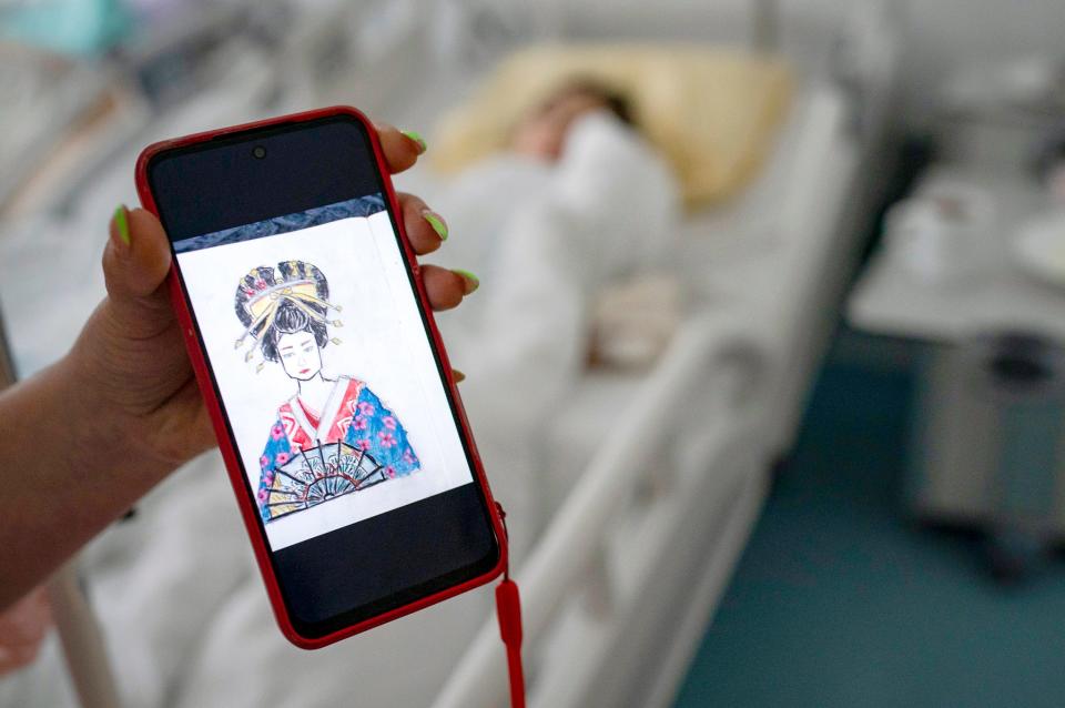 Vitalina Petrenko, 38, shows a photo of artwork created by her daughter, Karolina Petrenko,16, of Cherkasy, Ukraine, as she recovers from a surgery that released her fingers that were trapped in burn scar tissue contractures at the Independent Public Health Care Facility by in Leczna, Poland on Friday, May 19, 2023.