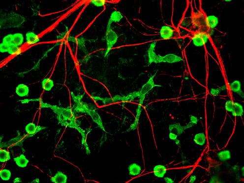 <span class="caption">Rat microglia in green.</span> <span class="attribution"><span class="source">wikipedia</span>, <a class="link " href="http://creativecommons.org/licenses/by-sa/4.0/" rel="nofollow noopener" target="_blank" data-ylk="slk:CC BY-SA;elm:context_link;itc:0;sec:content-canvas">CC BY-SA</a></span>