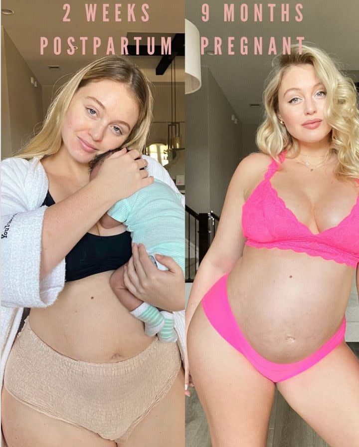 Model Iskra Lawrence shares a first look at her two-week-old son with her boyfriend Philip Payne and talked about the postpartum struggles she has been facing. "I’m prefacing this post by saying I could not be happier or more grateful and I’m highly aware that I’m super lucky to be able to conceive naturally and that myself and baby are healthy...NOTHING could have gotten me ready emotional and mentally to see the love of our lives screaming, bright red, whole body tense and seemingly in discomfort for hours a day and not getting enough sleep."