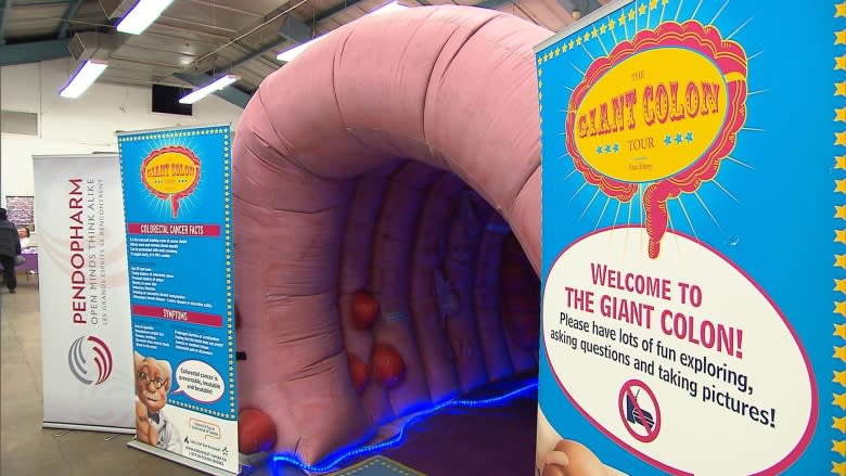 Inside your backside: Giant inflatable colon helps demystify colon cancer