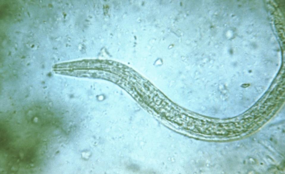 A microscopic image of a human hookworm. <a href="https://www.gettyimages.com/detail/news-photo/photomicrograph-of-human-hookworm-rhabditiform-larva-which-news-photo/901588546?adppopup=true" rel="nofollow noopener" target="_blank" data-ylk="slk:Smith Collection/Gado/Getty Images;elm:context_link;itc:0;sec:content-canvas" class="link ">Smith Collection/Gado/Getty Images</a>