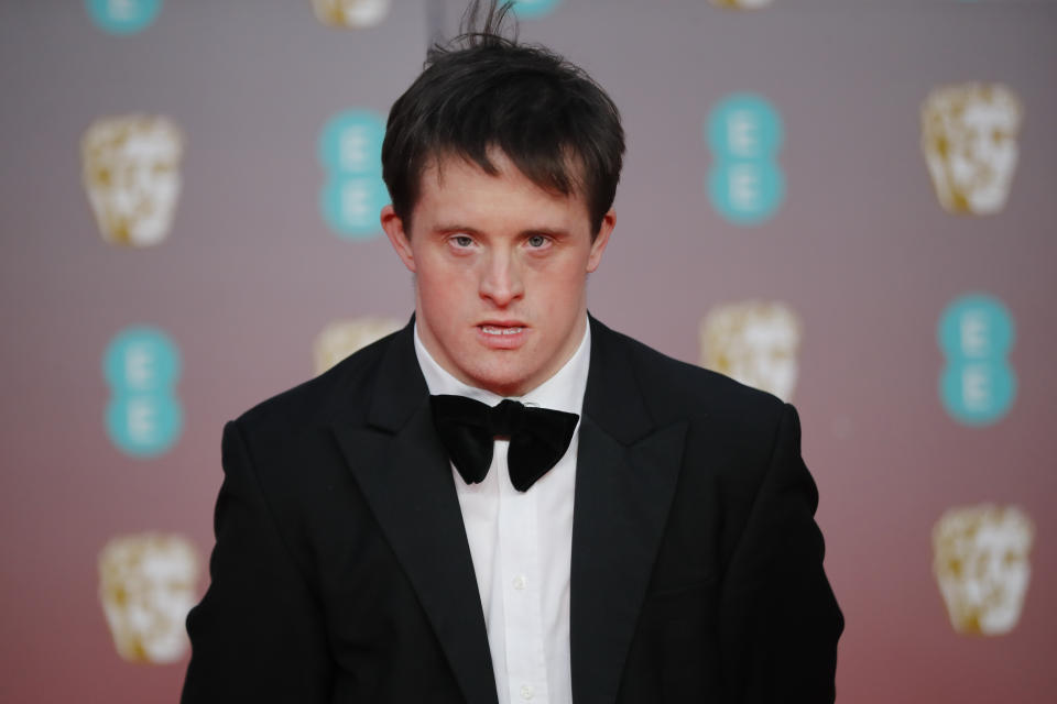 British actor Tommy Jessop poses on the red carpet upon arrival at the BAFTA British Academy Film Awards at the Royal Albert Hall in London on February 2, 2020. (Photo by Tolga AKMEN / AFP) (Photo by TOLGA AKMEN/AFP via Getty Images)