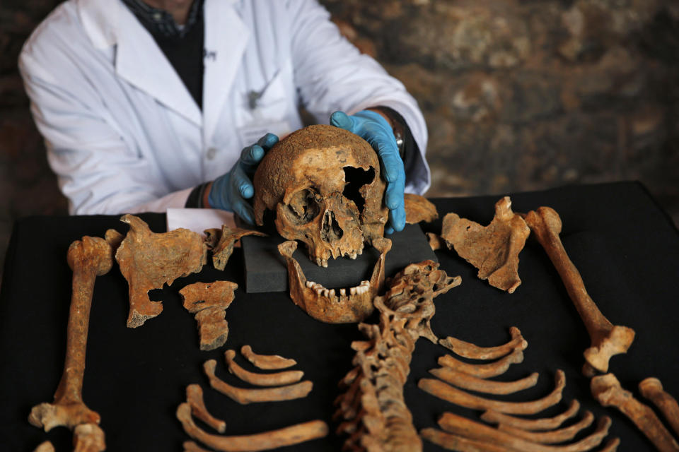 In this Wednesday, March 26, 2014 photo, Don Walker, a human osteologist with the Museum of London, holds the scull of one of the skeletons found by construction workers under central London's Charterhouse Square, while posing for photographers. Twenty-five skeletons were uncovered last year during work on Crossrail, a new rail line that's boring 13 miles (21 kilometers) of tunnels under the heart of the city. Archaeologists immediately suspected the bones came from a cemetery for victims of the bubonic plague that ravaged Europe in the 14th century. The Black Death, as the plauge was called, is thought to have killed at least 75 million people, including more than half of Britain's population. (AP Photo/Lefteris Pitarakis)
