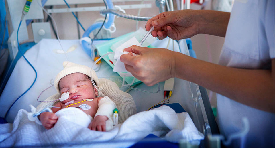 The infant boy, not the one pictured here, had to undergo serious procedures. Source: Getty 