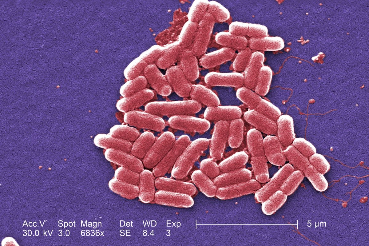 E.Coli bacteria (Centers for Disease Control and Prevention/PA) (PA Media)