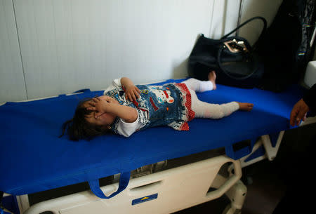 A patient Iraqi child lies at a hospital run by Medecins Sans Frontieres in Qayyara, Iraq April 6, 2017. REUTERS/Suhaib Salem