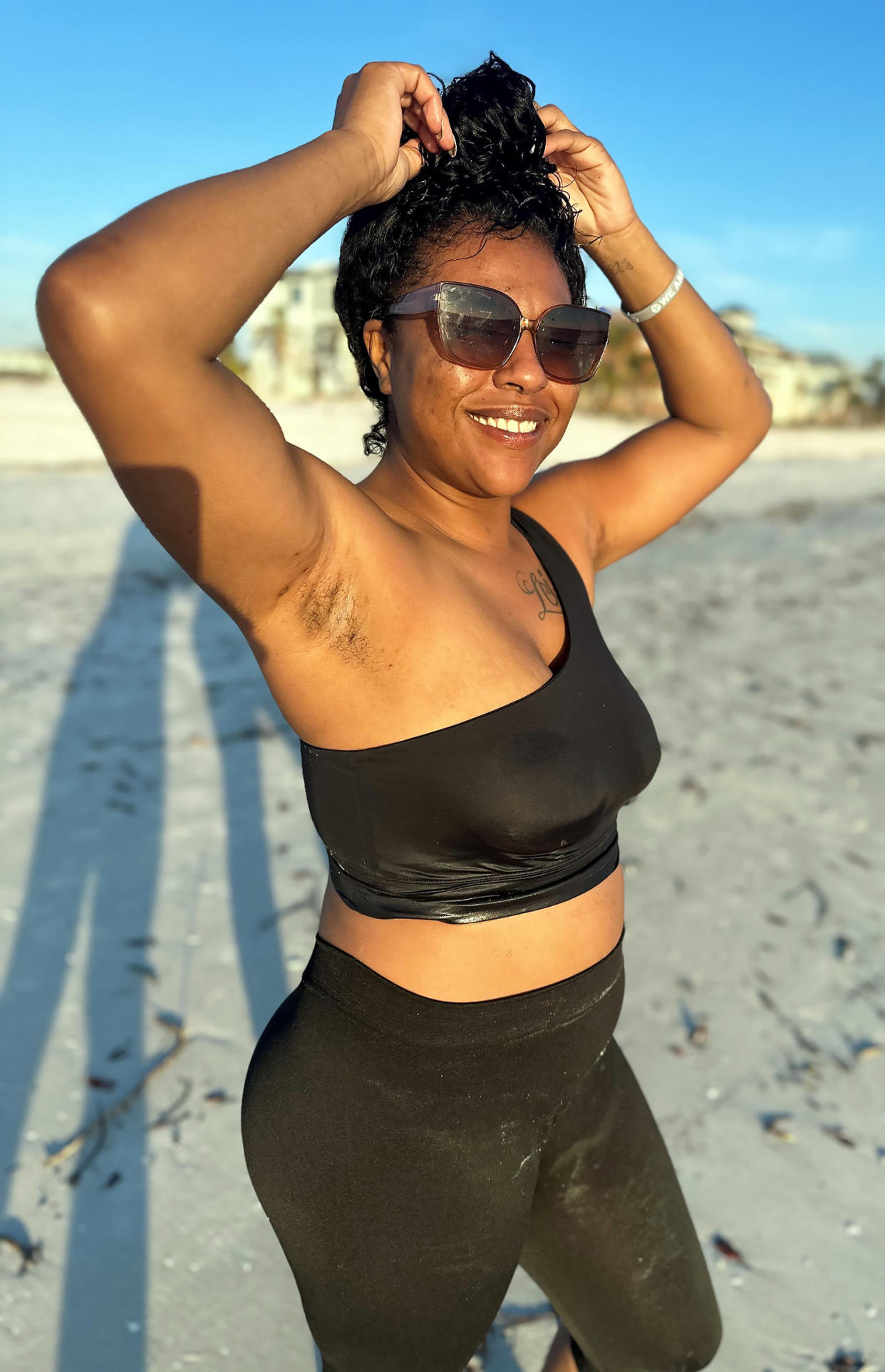 Cydney Carter wants to raise awareness of hidradenitis suppurative so that fewer people have delayed diagnosis and feel ashamed.  (Courtesy Cydney Carter)
