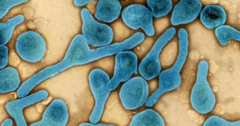 En África hay preocupación por un posible brote masivo del virus de Marburgo.