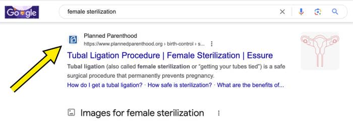 A screenshot of the tubal ligation procedure from the Planned Parenthood website link on Google search