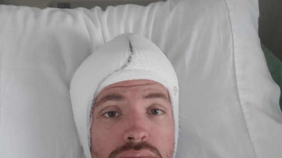 Army veteran Jay Tenison recovering after June 2022 surgery to remove a brain tumor. (Courtesy of Jay Tenison)