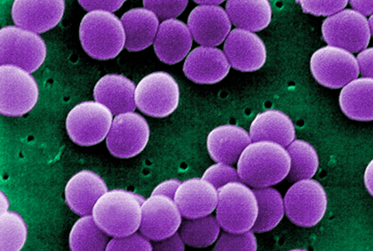 Staphylococcus Aureus, which can cause toxic shock syndrome, was found on all public transport (Wikipedia)