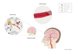 The potential penetration routes of COVID-19 virus to the brain. Once penetrated, the virus can bind and cause damage to neurons and glial cells. Within the blood vessels, the virus can induce thrombus formation causing brain infarcts.