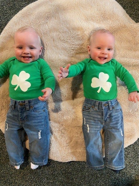Twins Luke and Liam Staples who, who turned 10 months old on April 6, 2024, underwent successful surgery to correct twin-twin transfusion syndrome.