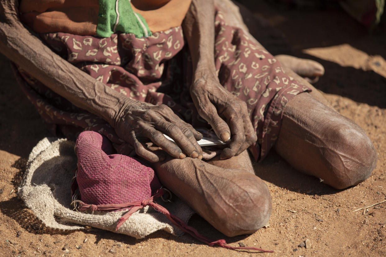 The hands and legs of an elderly person sitting on the ground.