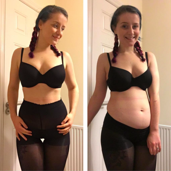 A blogger has been sharing side-by-side selfies to show how easy it is to fake transformation shots [Photo: Instagram/selfloveclubb]