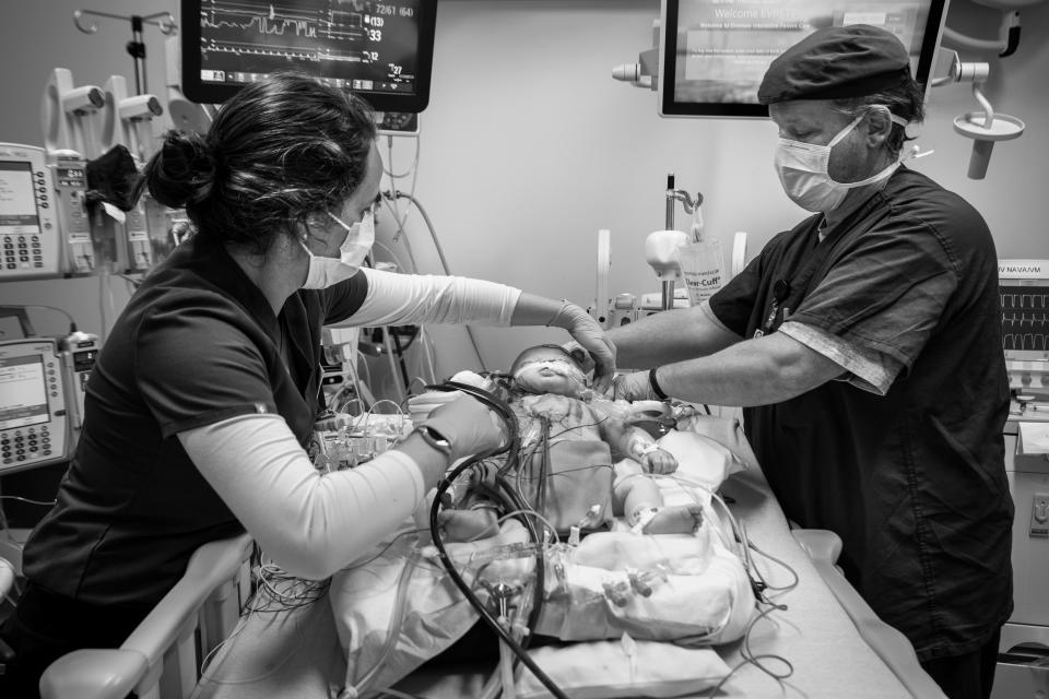 Nurse Mackenzie Riordan and Mike MacCormick an ECMO specialist help 6-month-old Evrett Sheffield, after a mechanical valve was placed in his heart. Evrett 's mother, Abby, created an Facebook group called "Evretts fight with Truncus Arteriosus!" to help raise awareness about his condition and long-term PICU stays. Evrett passed away  Oct. 15, 2021.