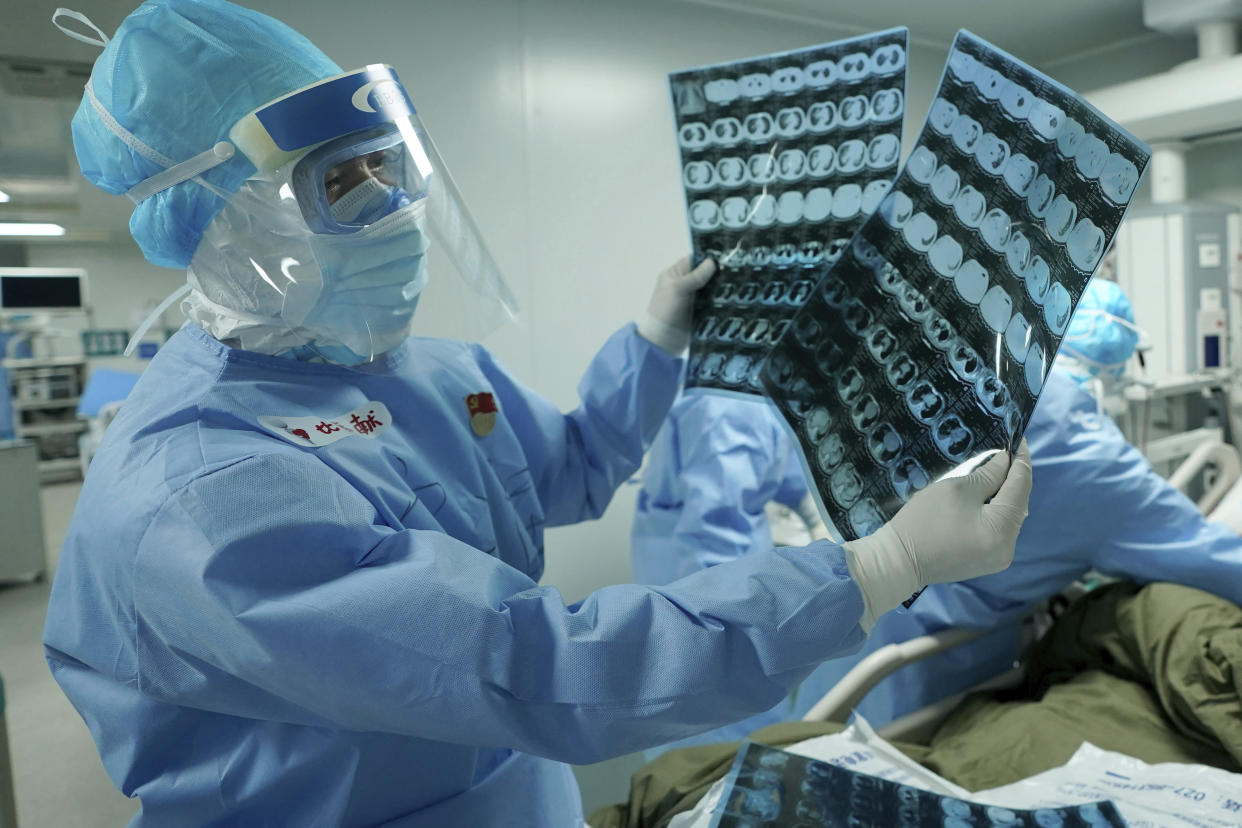 In this March 17, 2020, photo released by China's Xinhua News Agency, a medical worker looks at CT scans at the Huoshenshan field hospital in Wuhan in central China's Hubei Province. Top Chinese officials secretly determined they were likely facing a pandemic from a novel coronavirus in mid-January, ordering preparations even as they downplayed it in public. Internal documents obtained by the AP show that because warnings were muffled inside China, it took a confirmed case in Thailand to jolt Beijing into recognizing the possible pandemic before them. (Wang Yuguo/Xinhua via AP)