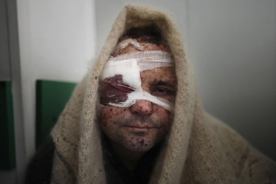 FILE - Serhiy Kralya, 41, looks at the camera after surgery at a hospital in Mariupol, eastern Ukraine on Friday, March 11, 2022. Kralya was injured during shelling by Russian forces. (AP Photo/Evgeniy Maloletka, File)