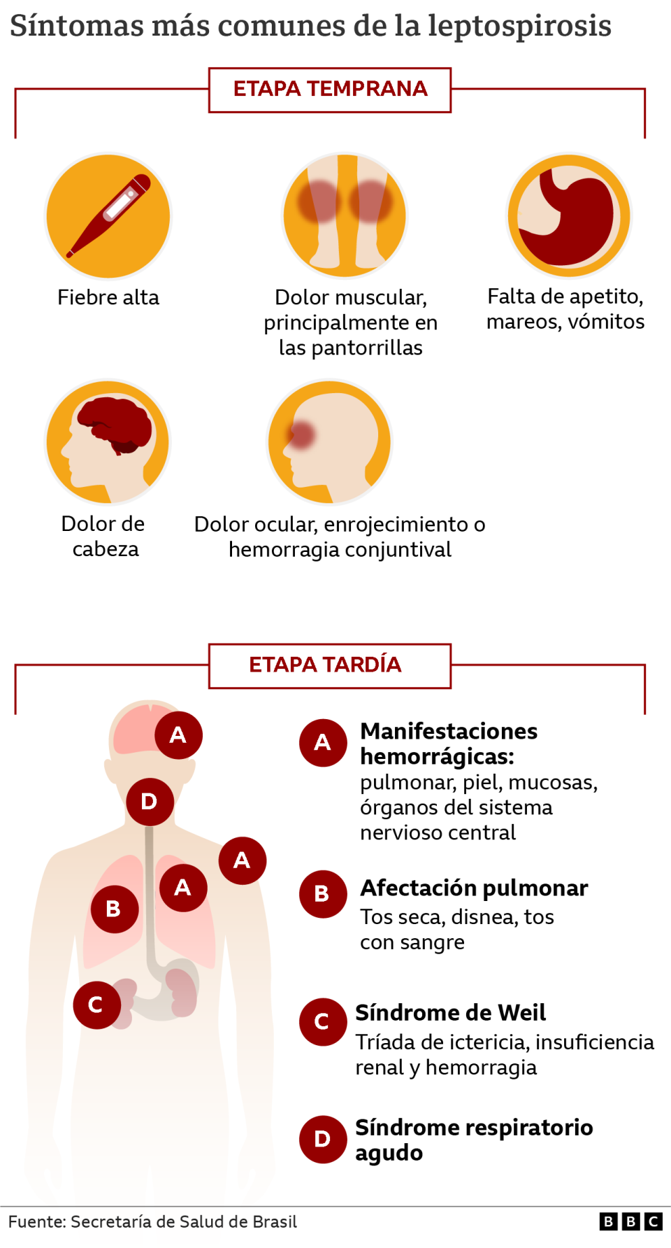 Gráfico con los síntomas de leptospirosis