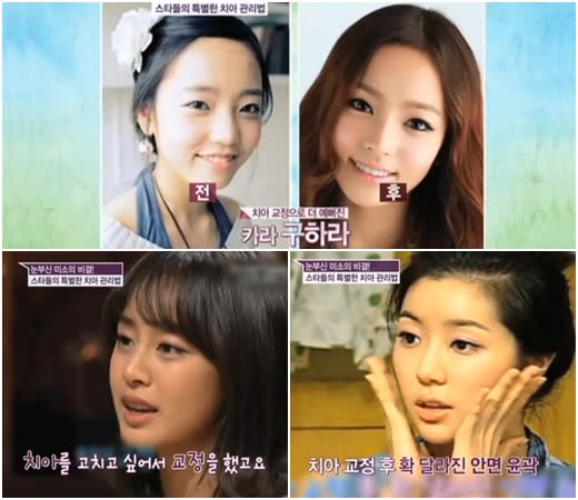 miryo brown eyed girls plastic surgery