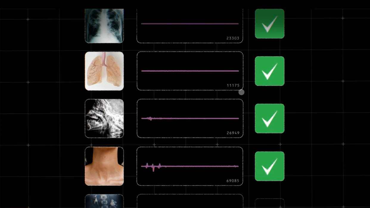 Google’s HeAR model sifts through over 300 million, two seconds snippets of audio to search for signs of respiratory harm.