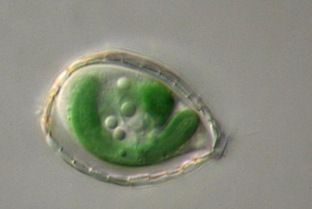 Una ameba del género 'Paulinella'
