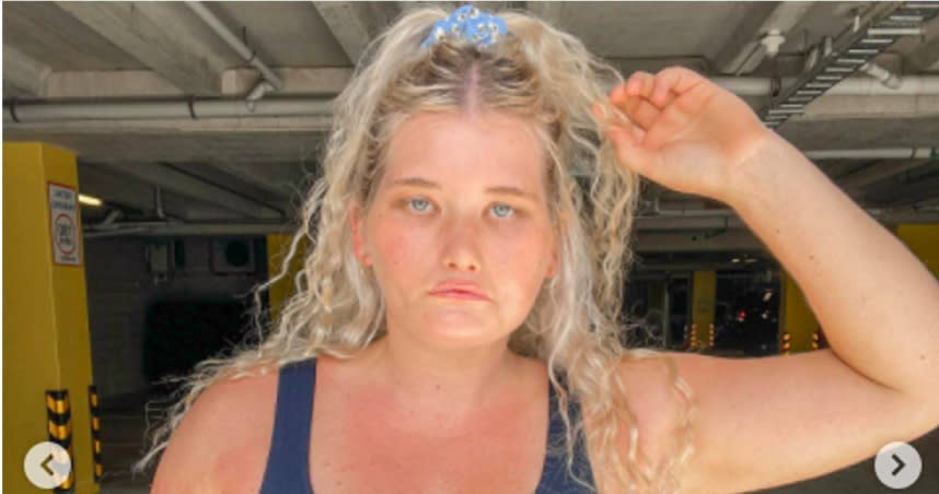 紐西蘭24歲女子罹患罕見疾病，無法控制臉部肌肉。（圖／翻攝自taylaclement IG）