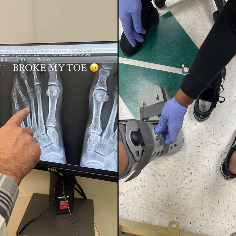 Travis Barker Broke His Toe Days After Celebrating His 47th Birthday With Wife Kourtney Kardashian 3