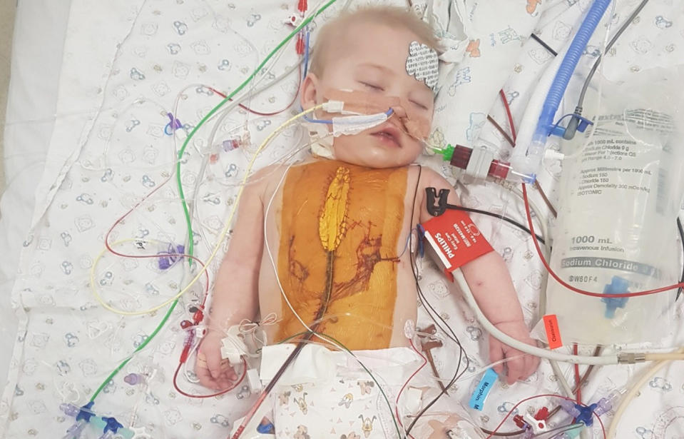 Little Lillian has spent most of her young life in hospital with a serious heart disease and other health complications. Source: GoFundMe