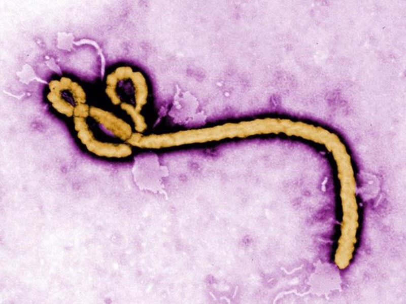 伊波拉病毒。（擷取美國疾管署推特@CDCgov）