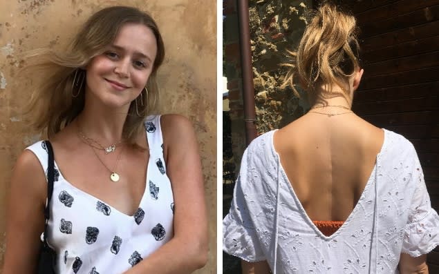 Tilly Armstrong underwent surgery to correct her spine's alignment, leaving a scar down her back