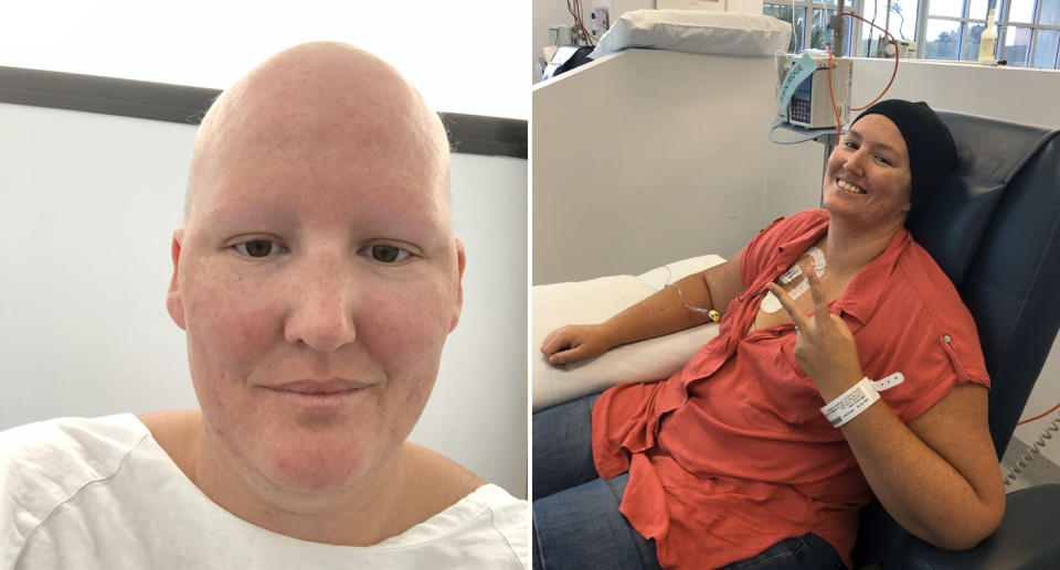 Erryn Sims during her cancer treatment. Source: Supplied/Erryn Sims