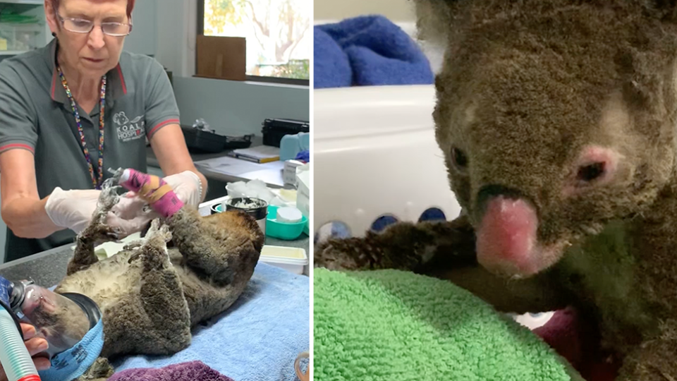 Split screen. Left - a volunteer at Koala Hospital Port Macquarie tends to a burnt koala on an operating table. Right - Close up of a koala with a burnt nose.