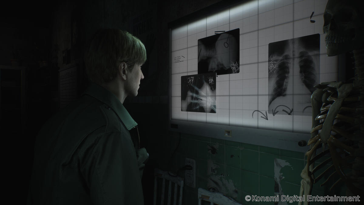 After Bloober's Silent Hill 2, Konami teases more Silent Hill remakes