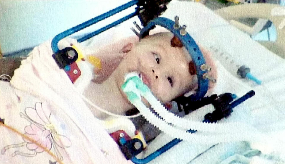 <em>After the crash, Cerys was unable to breathe normally and required a ventilator (Picture: SWNS)</em>