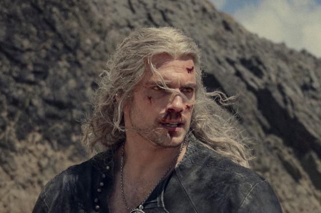 Henry Cavill injures leg on The Witcher set