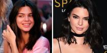 <p>Kendall Jenner's flawless skin speaks for itself - with or without makeup she's an absolute queen... </p>