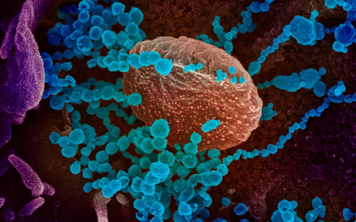 Professor Nick Loman of the University of Birmingham, who is part of the Covid-19 Genomics Consortium, said the new strand of the virus, known as D614G, is now the most dominant mutation globally - AFP