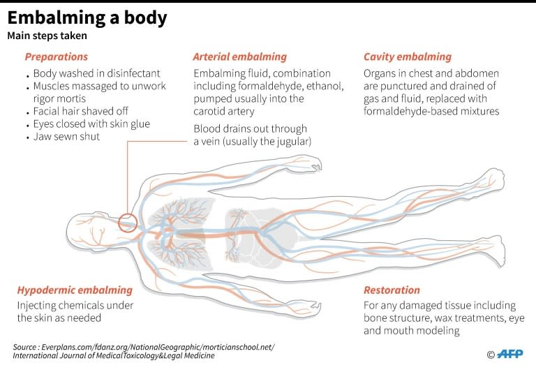 Embalming a body
