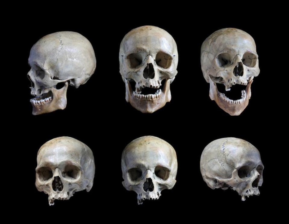 Ein Archivbild, das nur zu Illustrationszwecken verwendet wird und sechs menschliche Schädel zeigt. (Bild: IvancoVlad/Getty Images)
