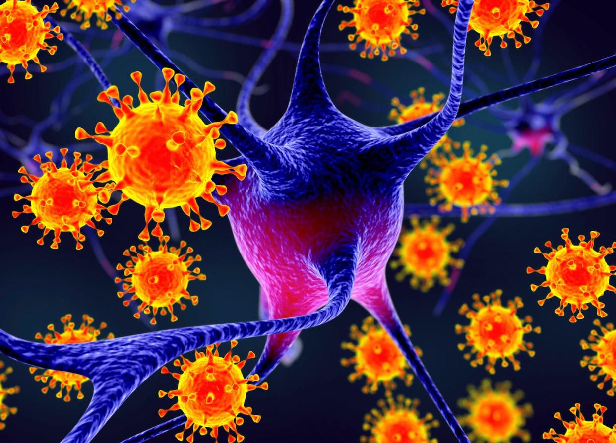 <a href="https://www.shutterstock.com/es/image-illustration/viruses-infecting-neurons-concept-brain-infection-1089713012" rel="nofollow noopener" target="_blank" data-ylk="slk:Kateryna Kon/Shutterstock;elm:context_link;itc:0;sec:content-canvas" class="link ">Kateryna Kon/Shutterstock</a>