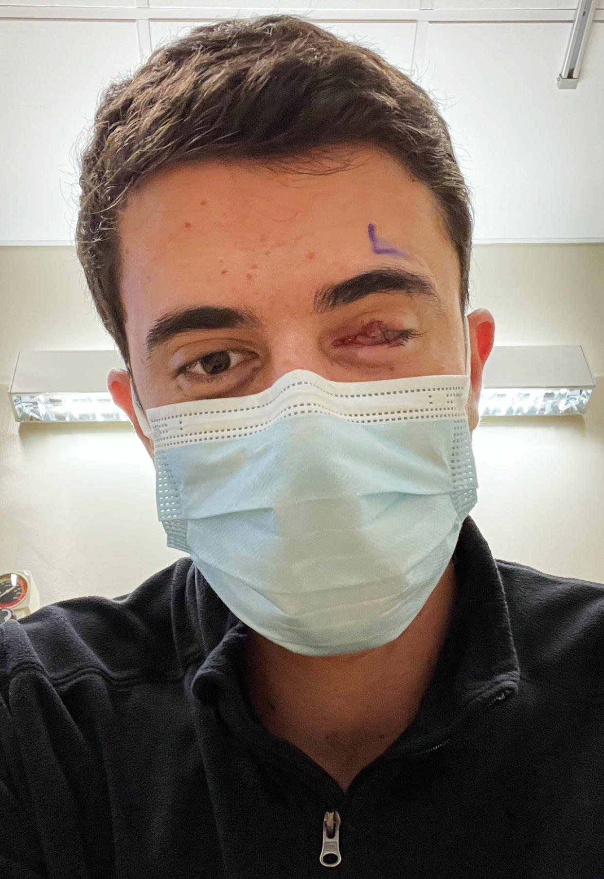 Nick Kharufeh before his surgery. (Courtesy Nick Kharufeh)