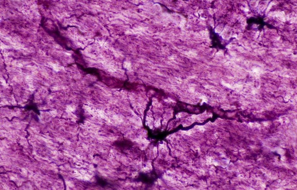 This image shows astrocytes, a type of brain cell, contacting a ravinelike capillary. <a href="https://www.gettyimages.com/detail/photo/astrocyte-in-the-brain-touching-a-capillary-250x-royalty-free-image/152883277" rel="nofollow noopener" target="_blank" data-ylk="slk:Ed Reschke/Stone via Getty Images;elm:context_link;itc:0;sec:content-canvas" class="link ">Ed Reschke/Stone via Getty Images</a>