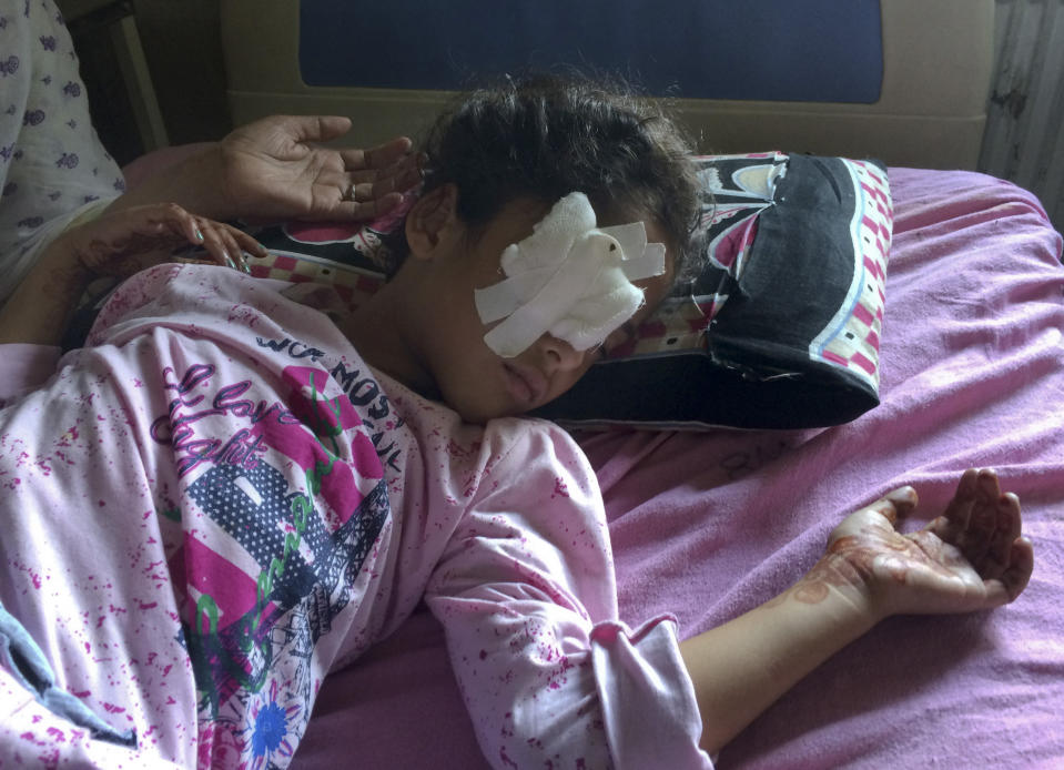 Six year old Kashmiri girl Muneefa Nazir, lies at a hospital bed after she was wounded by a marble shot from a sling used by Indian paramilitary soldiers in Srinagar Indian controlled Kashmir, Tuesday, Aug. 13, 2019. Indian Prime Minister Narendra Modi defended his government's controversial measure to strip the disputed Kashmir region of its statehood and special constitutional provisions in an Independence Day speech Thursday, as about 7 million Kashmiris stayed indoors for the 11th day of an unprecedented security lockdown and communications blackout. (AP Photo/ Aijaz Hussain)