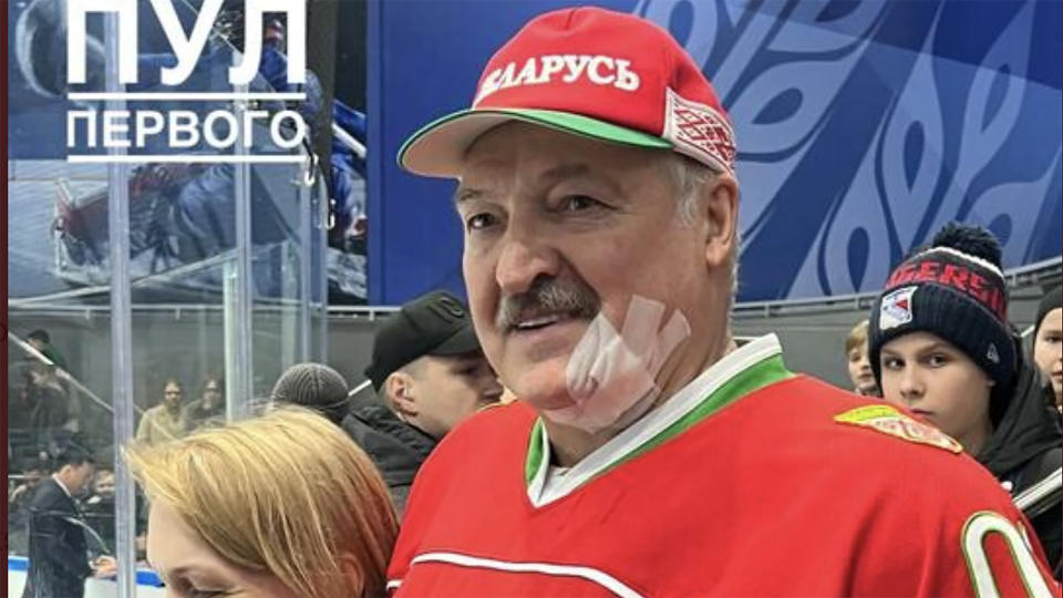 President of Belarus Alexander Lukashenko had to leave a hockey game after being struck in the face by a stick. (Photo via @franakviacorka/Twitter)