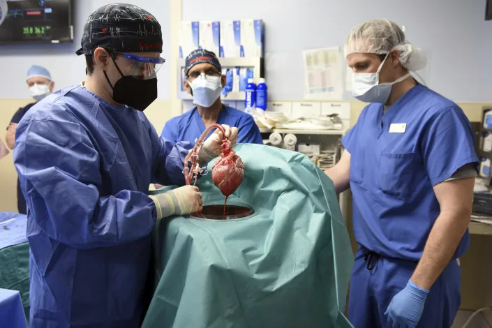 FILE - In this photo provided by the University of Maryland School of Medicine, members of the surgical team show the pig heart for transplant into patient David Bennett in Baltimore on Friday, Jan. 7, 2022. On Monday, Jan. 10, 2022 the hospital said that he's doing well three days after the highly experimental surgery. Bennett, the first person to receive a heart transplant from a pig died Tuesday, March 8, at the University of Maryland Medical Center, two months after the groundbreaking experiment. His death was announced Wednesday. (Mark Teske/University of Maryland School of Medicine via AP, File)