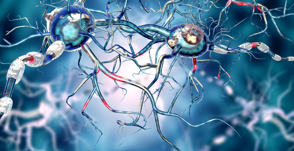 La Enfermedad de Parkinson se produce por un deterioro neurodegenerativo que daña al Sistema Nervioso Central. (Foto: Getty)