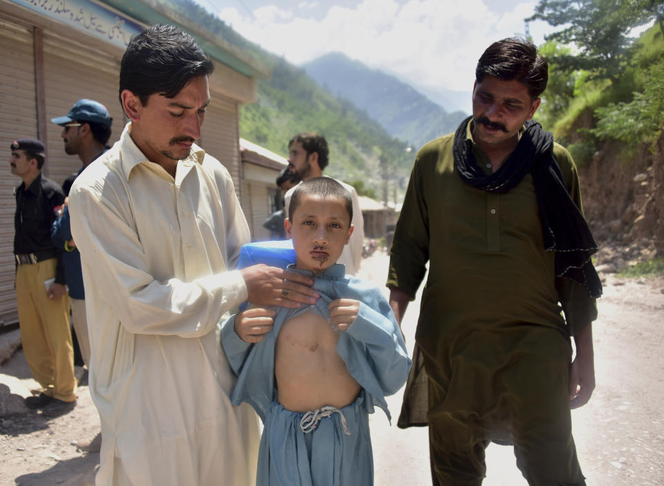 A Pakistani Kashmiri father, left, shows the wounds his son Mazhar Hussain received when Indian forces fired on Nosehri village on the Line of Control that divides Kashmir between Pakistan India, near Muzaffarabad, Pakistan, Sunday, Aug. 4, 2019. Tensions have soared along the volatile, highly militarized frontier between India and Pakistan in the disputed Himalayan region of Kashmir, as India deployed more troops and ordered thousands of visitors out of the region. (AP Photo/M.D. Mughal)